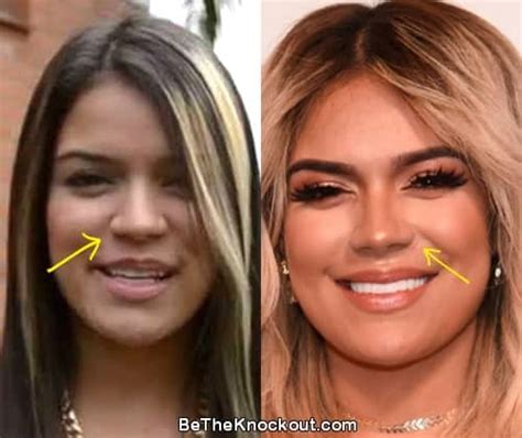 Karol G: Before and After